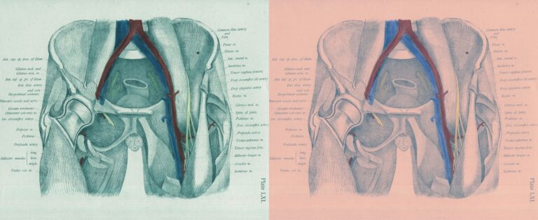 psoas